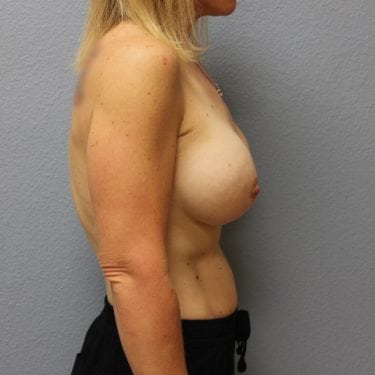 After Image