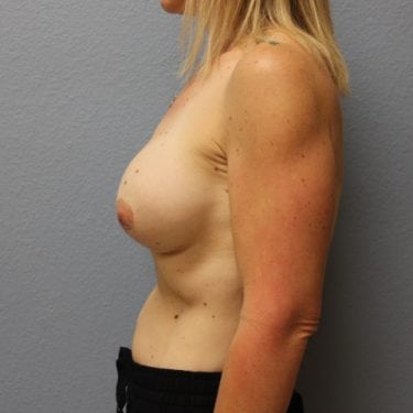 After Image