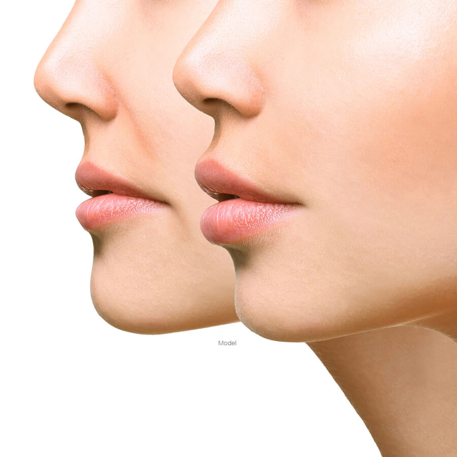 Profile of two women's lower face