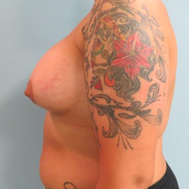 After Image